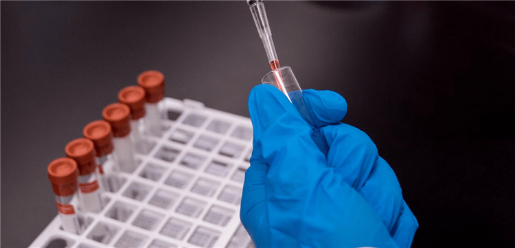 Koronavirüs Hastalığında PCR Testi Nasıl Uygulanır?